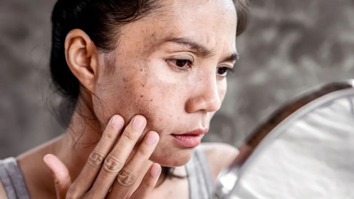 Woman looking at sun damaged skin in mirror