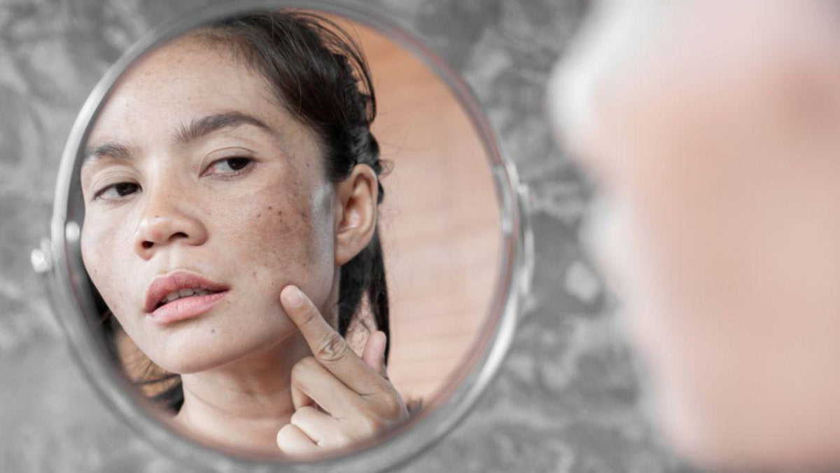 Woman viewing sun damaged skin in mirror