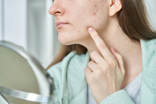 Closeup of female with red acne spots on chin and cheek looking at mirror